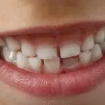 Come lavare correttamente i denti a scuola