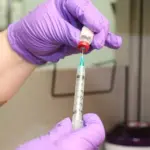 Morbillo, otto casi a Bari sospetto contagio da figlio di No Vax